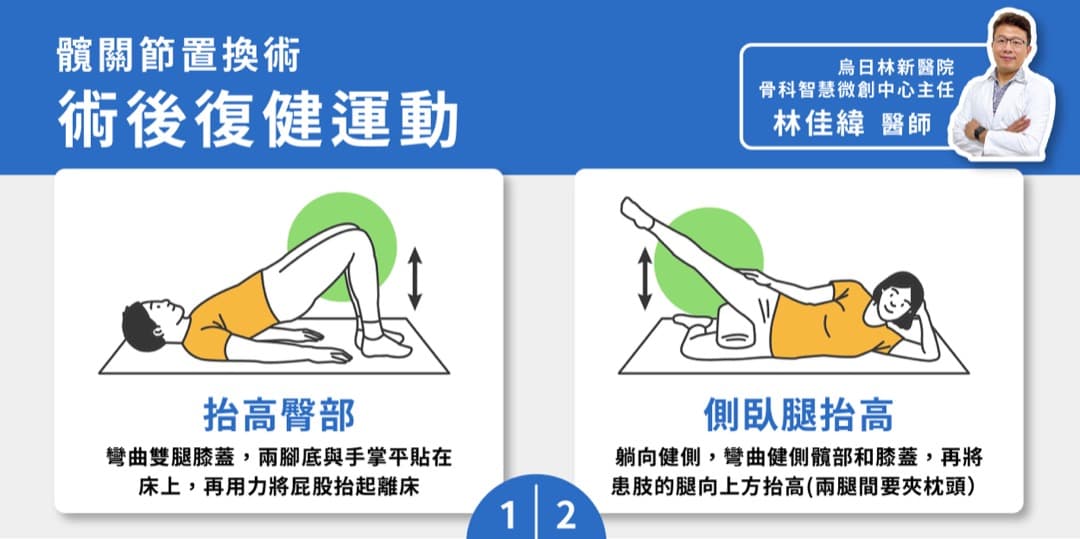 髖關節置換術後復健怎麼做？居家運動完整指南