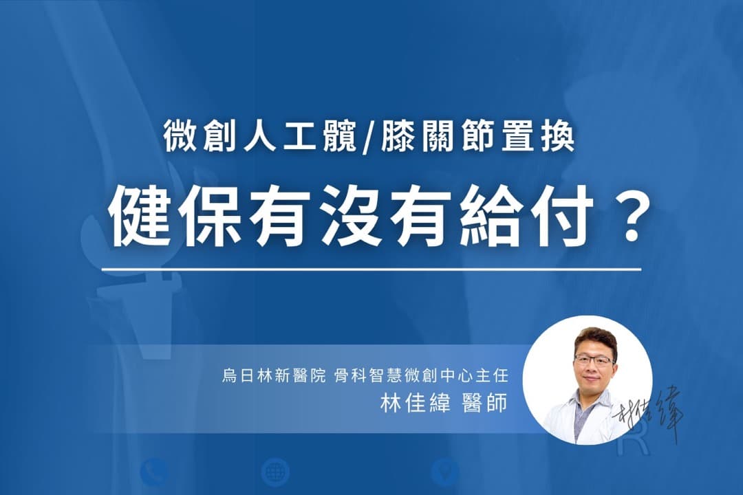 人工關節健保有給付嗎？自費與健保的差別一次搞懂