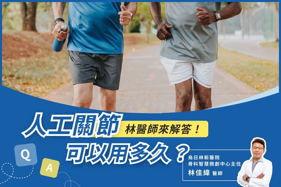 人工關節可以用多久？影響壽命的 5 個因素