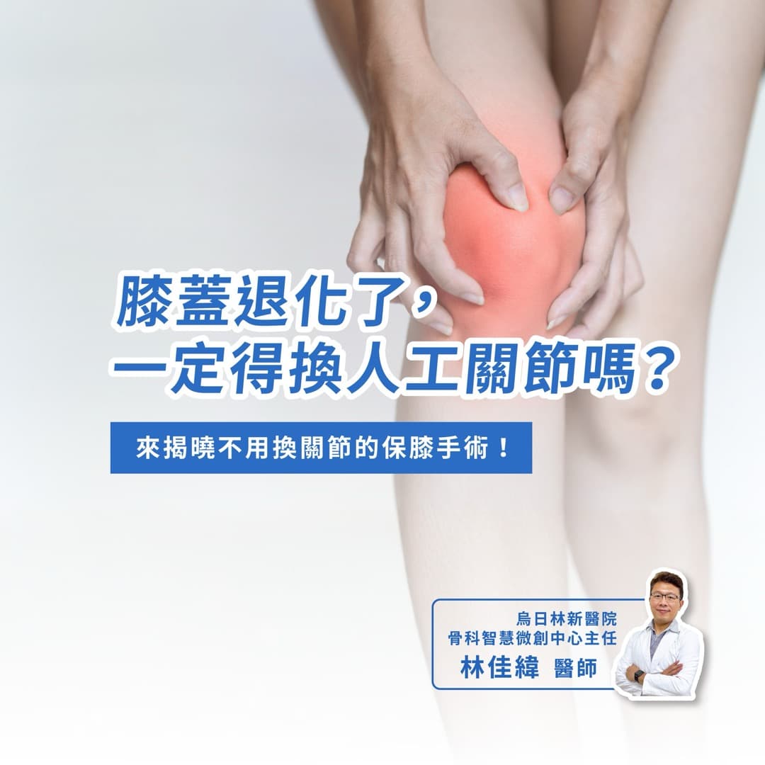 膝蓋退化一定要換人工關節嗎？認識保膝手術