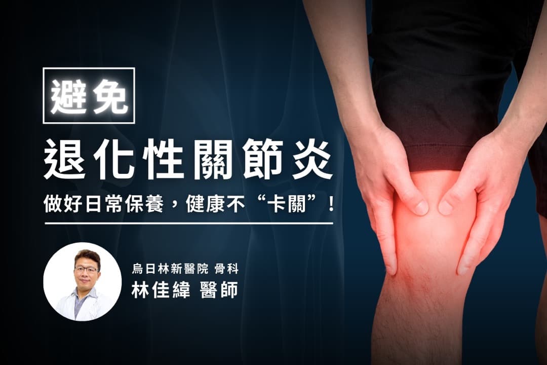 做好這幾件事，膝蓋不「卡關」——預防退化性關節炎