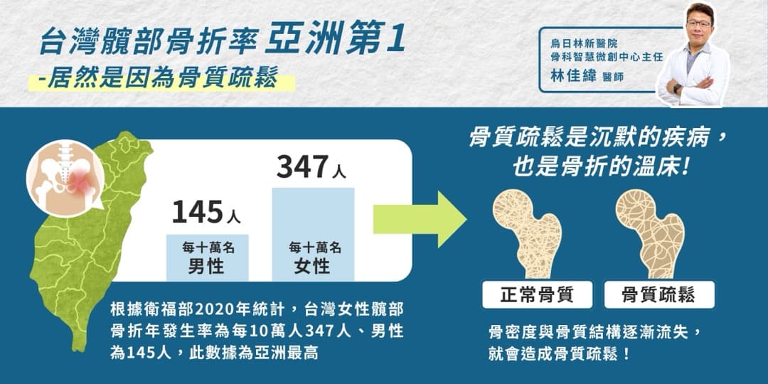 台灣髖部骨折率亞洲第一——你該知道的風險與預防