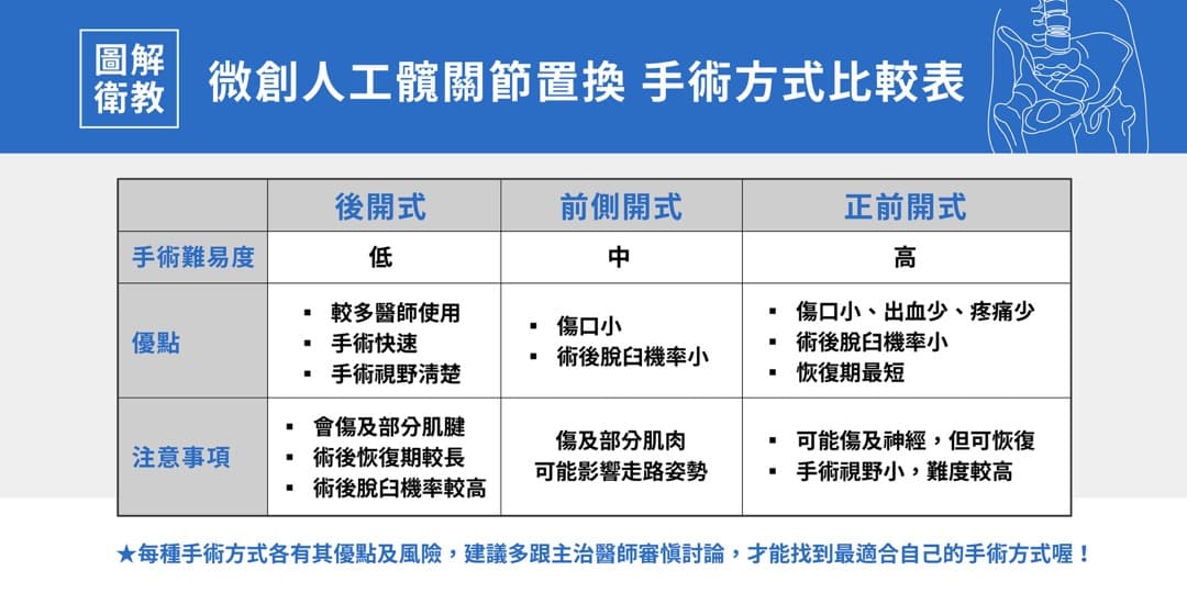 正前開式髖關節手術 — 圖 2/3
