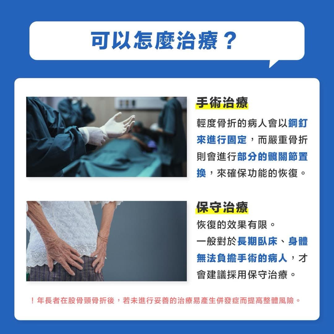 股骨頸骨折 — 圖 3/4