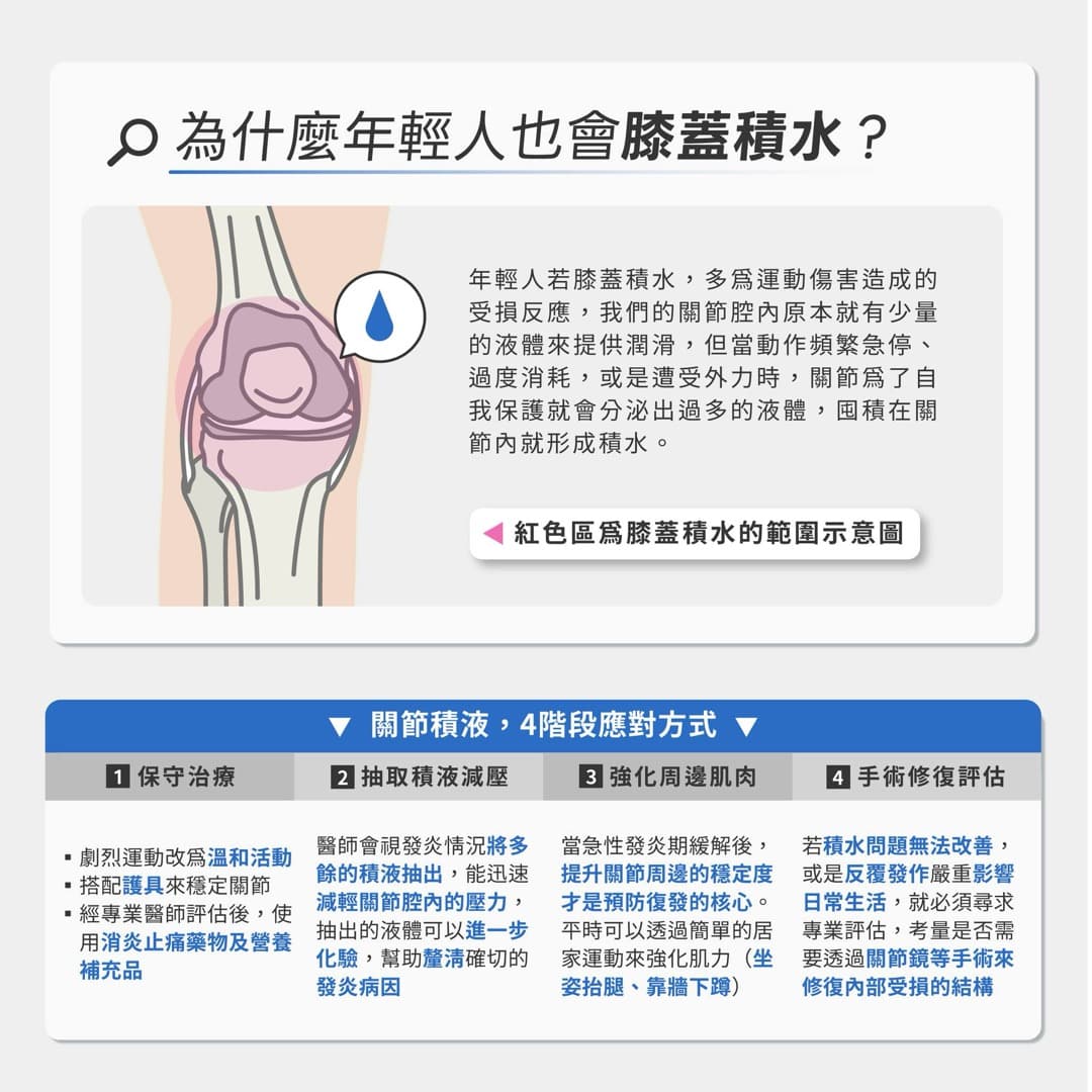 膝蓋積水 — 圖 2/2