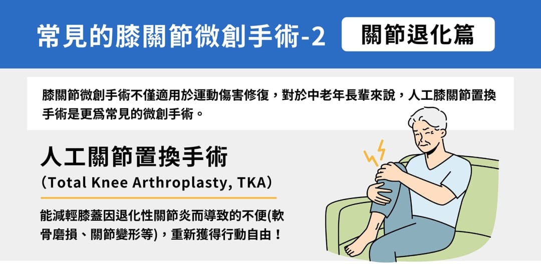 常見的膝關節微創手術——關節退化 — 圖 1/2