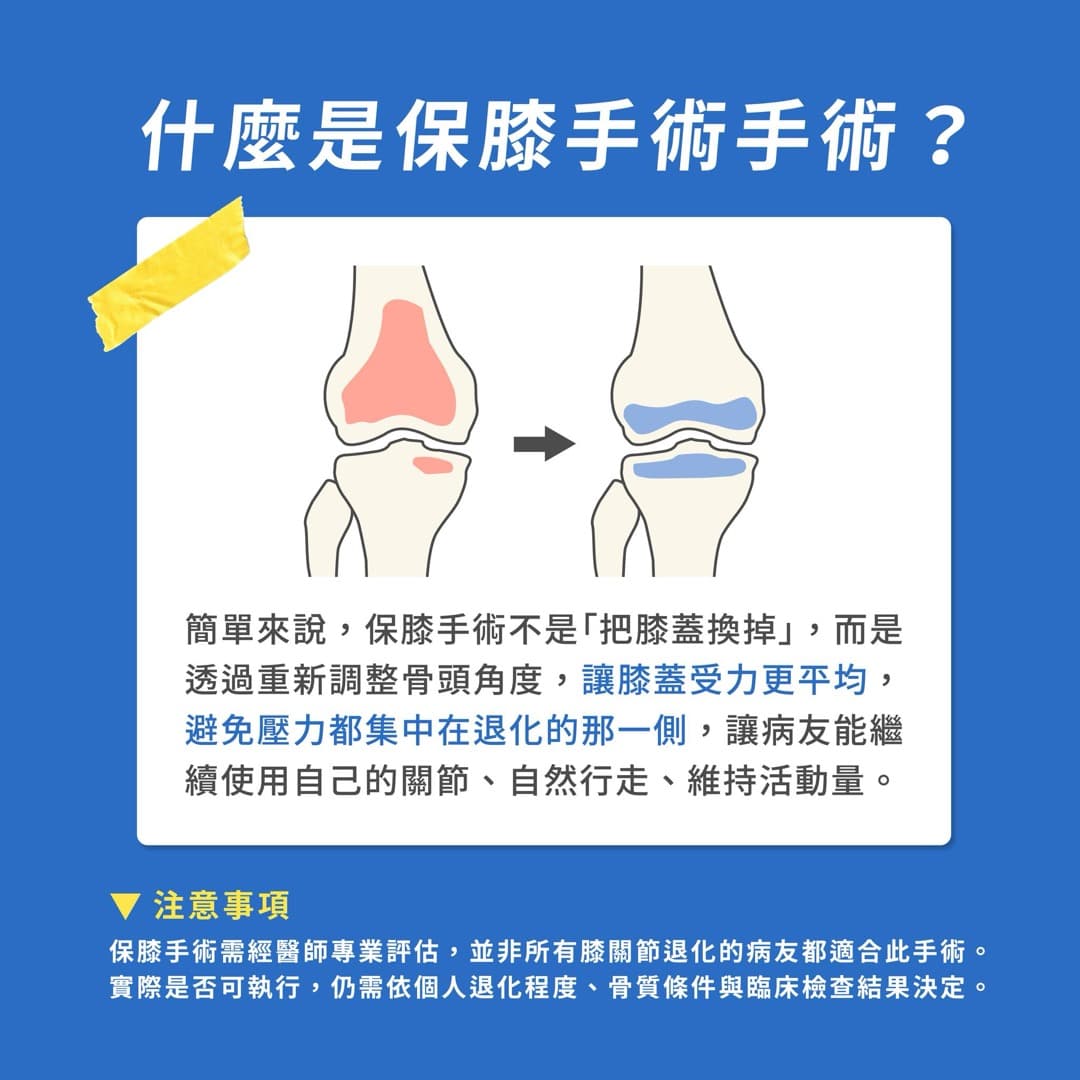 保膝手術 — 圖 2/5