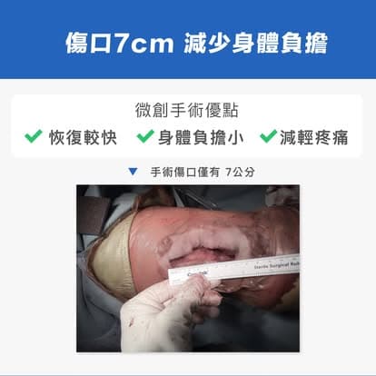 追求微創 — 圖 3/5