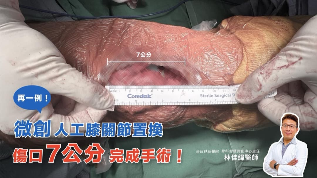 追求微創 — 圖 5/5