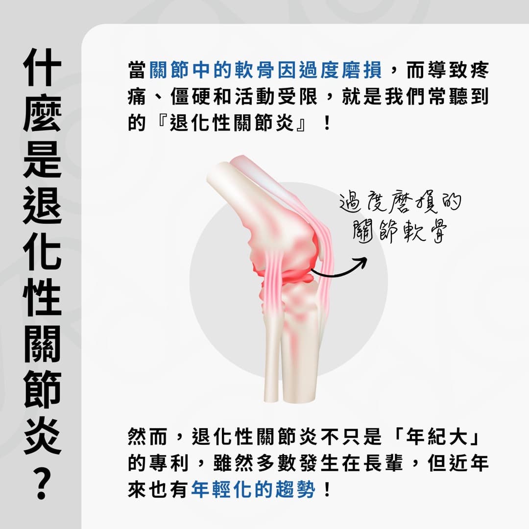避免退化性關節炎 — 圖 4/4