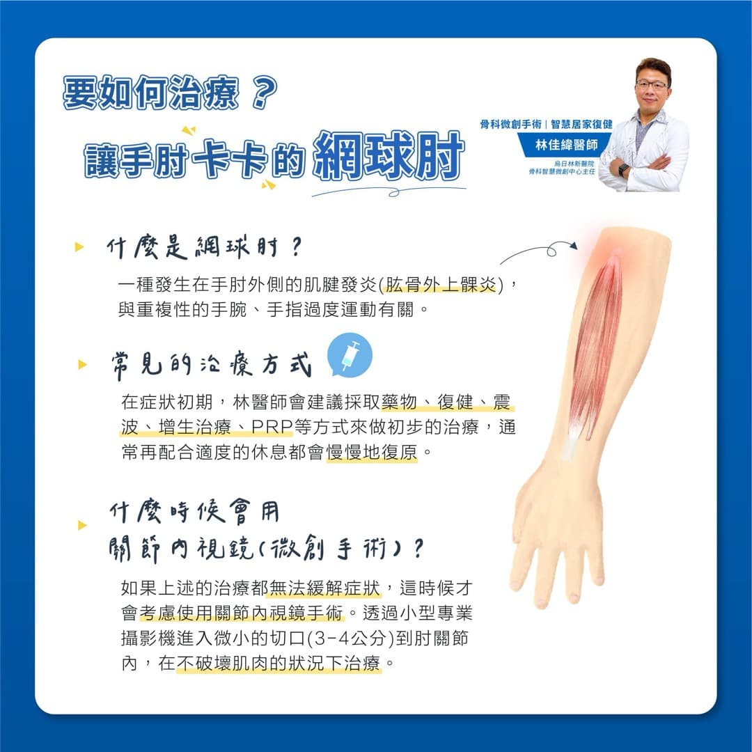 如何治療網球肘 — 圖 1/1