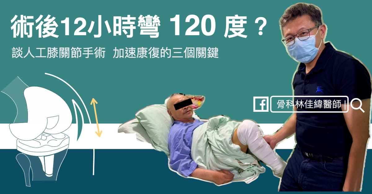 術後 12 小時膝蓋彎到 120 度?談 TKA 加速康復的三個關鍵